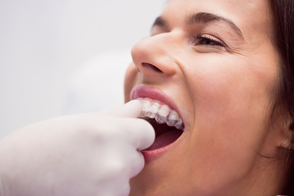 dentist-assisting-female-patient-wear-braces
